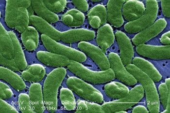 scanning electron microscope image of bacteria of the species Vibrio vulnificus