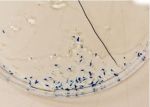Abbildung 3: Über 18S rRNA basierte Gensonden gefärbtes Zooplankton (Foto: Thorben Hofmann)