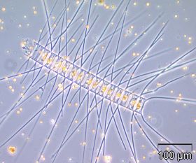 Chaetoceros decipiens