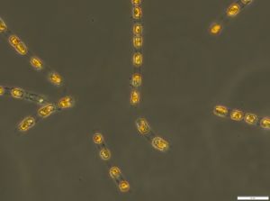 Fully active again even after around 7000 years without light and oxygen in the Baltic Sea sediment: the diatom Skeletonema marinoi.